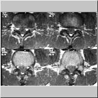 ScSL18,17,14,12K.jpg