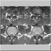 ScSL18,17,14,12.jpg