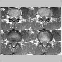 ScSL20,19,16,15.jpg